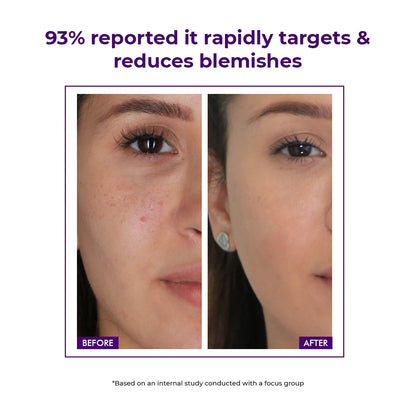 Dark Spot Removal & Daily Protection Kit